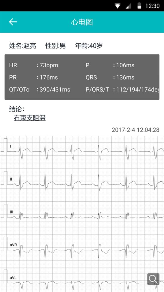 心电图安卓版心电图纸十二导心电图纸-第1张图片-太平洋在线下载